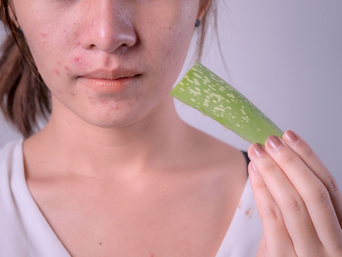 How effective is aloe vera for scars